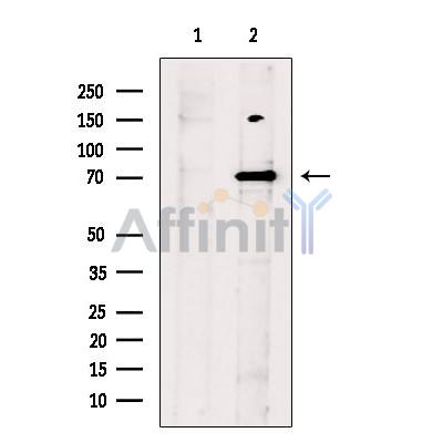 PARG Antibody - Western blot analysis of extracts from Mouse  brain, using PARG Antibody.