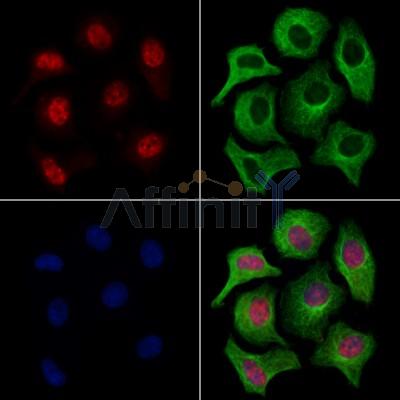 LMX1A Antibody - DF13518 staining Hela cells by IF/ICC.