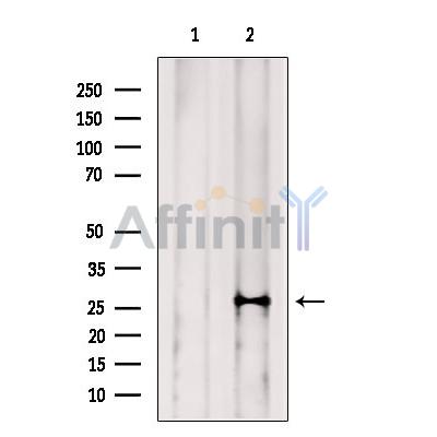 NAT14 Antibody - Western blot analysis of extracts from Mouse  brain, using NAT14 Antibody.