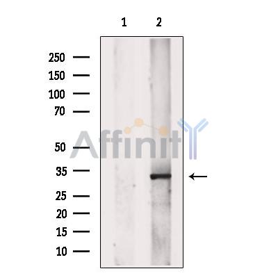 SET Antibody - Western blot analysis of extracts from Rat  muscle, using SET Antibody.