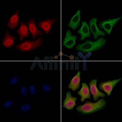 SET Antibody - DF13529 staining Hela cells by IF/ICC.
