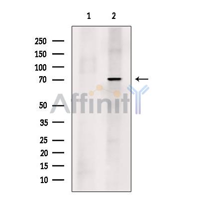 Proprotein Convertase 2 Antibody - Western blot analysis of extracts from Rat  brain, using Proprotein Convertase 2 Antibody.