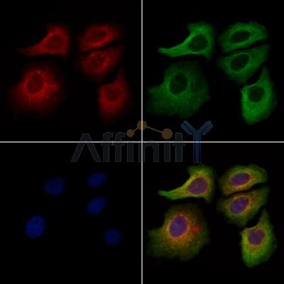 ACTR1A Antibody - DF13535 staining Hela cells by IF/ICC.