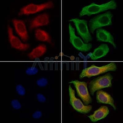 Ferredoxin Reductase Antibody - DF13537 staining Hela cells by IF/ICC.