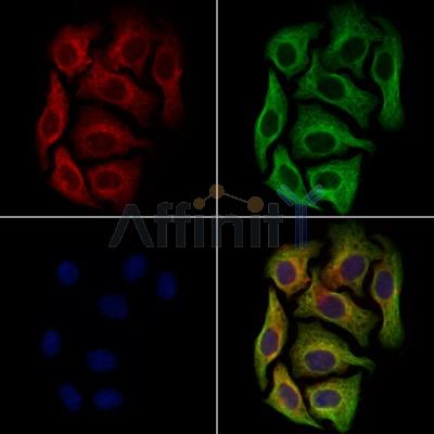 PEN2 Antibody - DF13538 staining Hela cells by IF/ICC.