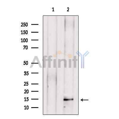 PEN2 Antibody - Western blot analysis of extracts from Rat  brain, using PEN2 Antibody.