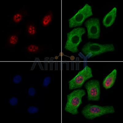 SMARCA1 Antibody - DF13543 staining Hela cells by IF/ICC.