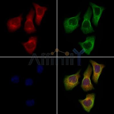 DPP6 - Catalytic domain Antibody - DF13546 staining Hela cells by IF/ICC.