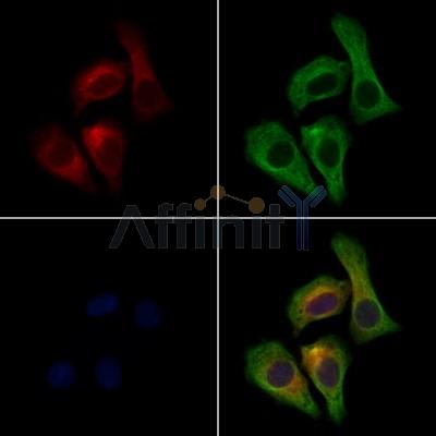 MAPRE1 Antibody - DF13549 staining Hela cells by IF/ICC.