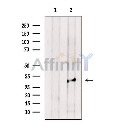 MAPRE1 Antibody - Western blot analysis of extracts from Rat  brain, using MAPRE1 Antibody.