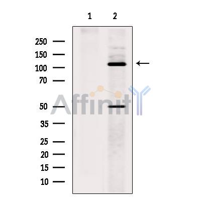 Kinesin 5 C Antibody - Western blot analysis of extracts from Rat  brain, using Kinesin 5 C Antibody.