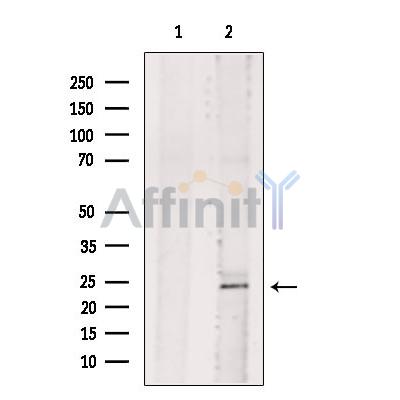 BASP1 Antibody - Western blot analysis of extracts from 3T3, using BASP1 Antibody.