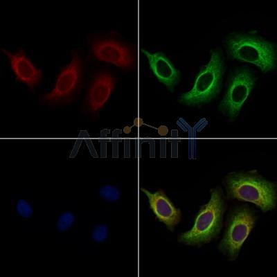 BASP1 Antibody - DF13578 staining Hela cells by IF/ICC.