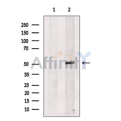 Nogo Receptor Antibody - Western blot analysis of extracts from PC12, using Nogo Receptor Antibody.