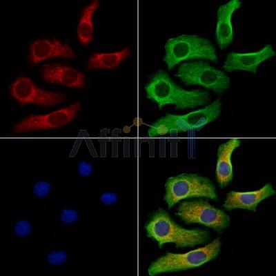 Nesprin 1 Antibody - DF13608 staining Hela cells by IF/ICC.