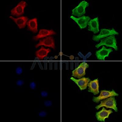 CTRP3 Antibody - DF13632 staining Hela cells by IF/ICC.