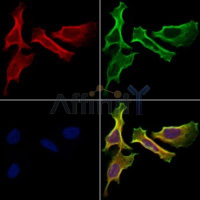 Hhip Antibody - DF13634 staining Hela cells by IF/ICC.