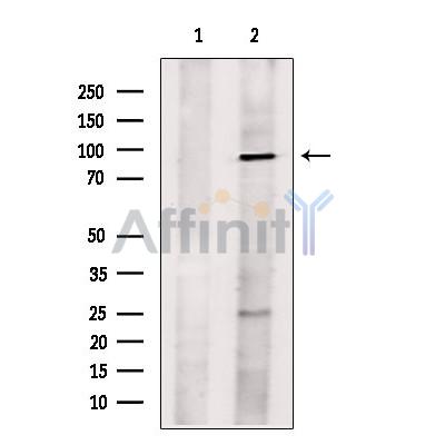 L3MBTL1 Antibody - Western blot analysis of extracts from Hela cells, using L3MBTL1 Antibody.