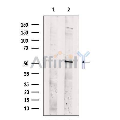 SLC16A8 Antibody - Western blot analysis of extracts from Mouse  testis, using SLC16A8 Antibody.