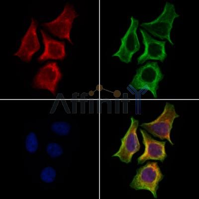 SLC16A8 Antibody - DF13644 staining Hela cells by IF/ICC.