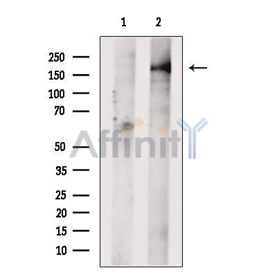 GREB1 Antibody - Western blot analysis of extracts from C6 cells, using GREB1 Antibody.