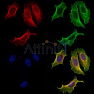 Apolipoprotein M Antibody - DF13650 staining Hela cells by IF/ICC.