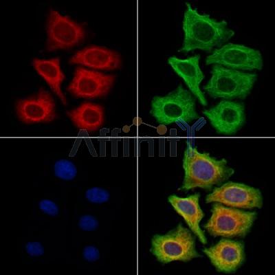 Filaggrin Antibody - DF13653 staining Hela cells by IF/ICC.