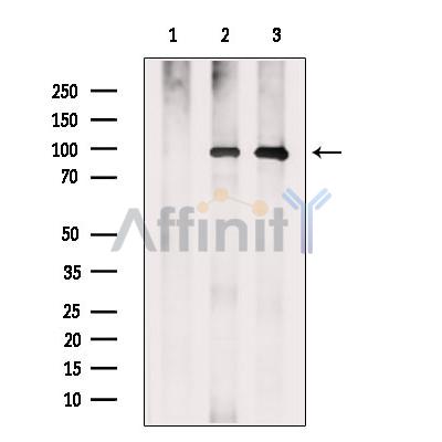Argonaute 4 Antibody - Western blot analysis of extracts from various samples, using Argonaute 4 Antibody.