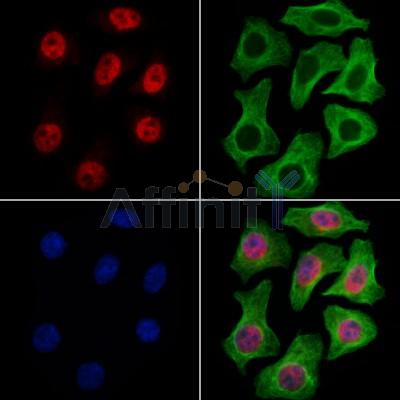 RECQL5 Antibody - DF13664 staining Hela cells by IF/ICC.