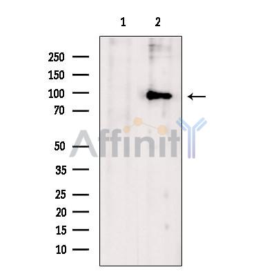 Zfp281 Antibody - Western blot analysis of extracts from Huvec, using Zfp281 Antibody.