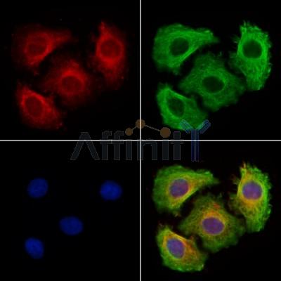 EB3 Antibody - DF13698 staining Hela cells by IF/ICC.