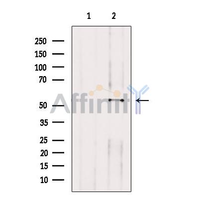 Hyaluronan synthase 2 Antibody - Western blot analysis of extracts from B16F10 cells, using Hyaluronan synthase 2 Antibody.