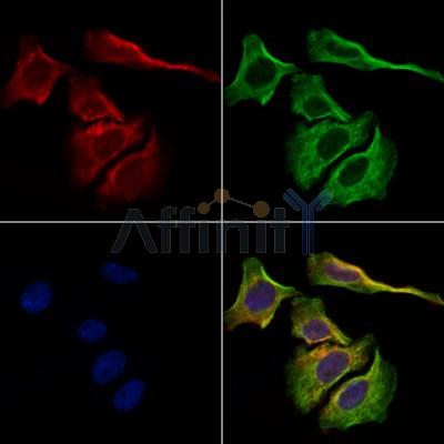 Kappa light chain Antibody - DF13703 staining Hela cells by IF/ICC.