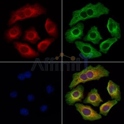 TCTEX1D2 Antibody - DF13706 staining Hela cells by IF/ICC.