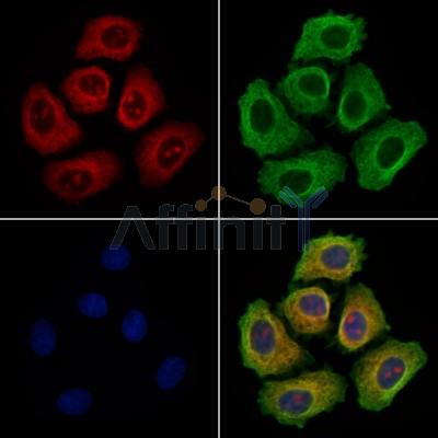 DERL2 Antibody - DF13711 staining Hela cells by IF/ICC.