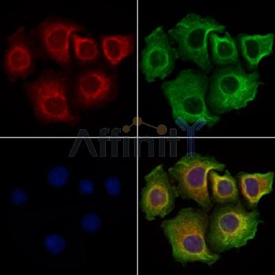 CCDC28A Antibody - DF13712 staining Hela cells by IF/ICC.