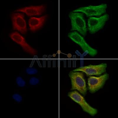 SCAP Antibody - DF13713 staining Hela cells by IF/ICC.