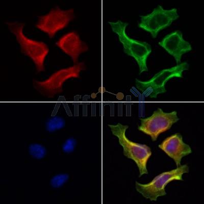TTC7A Antibody - DF13728 staining Hela cells by IF/ICC.