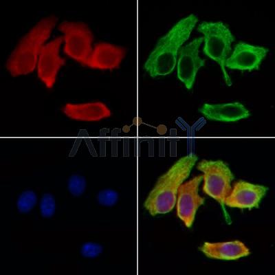 Thymosin beta 10 Antibody - DF13736 staining Hela cells by IF/ICC.