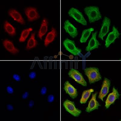 SEC61A Antibody - DF13740 staining Hela cells by IF/ICC.