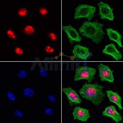 Histone H1.1 Antibody - DF13743 staining Hela cells by IF/ICC.