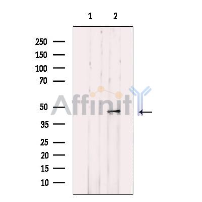 PDHA2 Antibody - Western blot analysis of extracts from NCI-H460 cells, using PDHA2 Antibody.