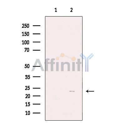 Virion infectivity factor Antibody - Western blot analysis of extracts from HEK293, using Virion infectivity factor Antibody.