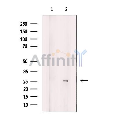 INSL6 Antibody - Western blot analysis of extracts from Human fetal kidney, using INSL6 Antibody.