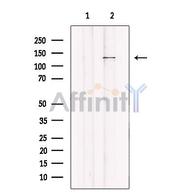 JMY Antibody - Western blot analysis of extracts from Jurkat, using JMY Antibody.