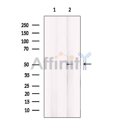 ADCK3 Antibody - Western blot analysis of extracts from HepG2, using ADCK3 Antibody.