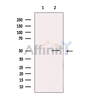 ZNF436 Antibody - Western blot analysis of extracts from HeLa cells, using ZNF436 Antibody.