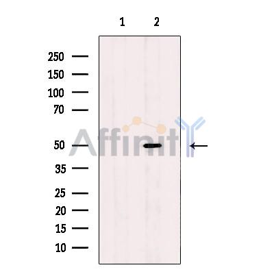 CADM1 Antibody - Western blot analysis of extracts from Mouse brain, using CADM1 Antibody.