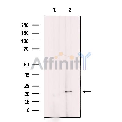 MRPL11 Antibody - Western blot analysis of extracts from COS cells, using MRPL11 Antibody.