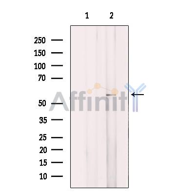 ARFGAP3 Antibody - Western blot analysis of extracts from HeLa cells, using ARFGAP3 Antibody.